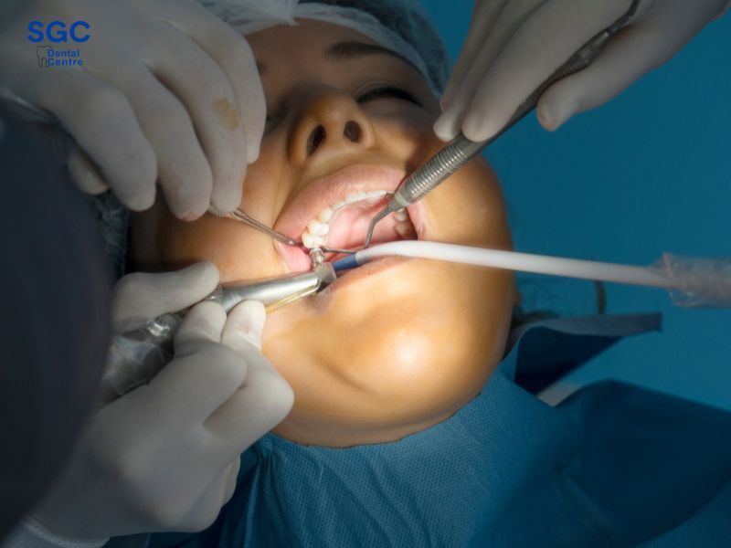 Lựa chọn thời điểm thích hợp để trồng răng Implant