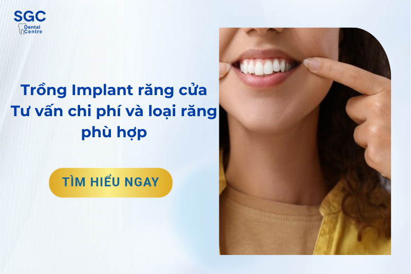 Trồng Implant răng cửa