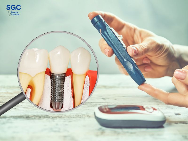 Bị tiểu đường cần kiểm tra sức khỏe kỹ lưỡng khi trồng Implant