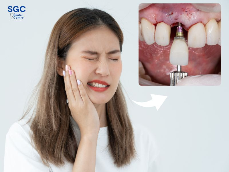 Có thể đau nhức khi cắm trụ Implant