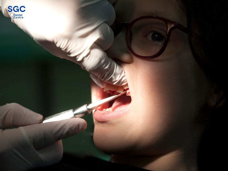 Người bị mất răng nên được trồng răng Implant sớm