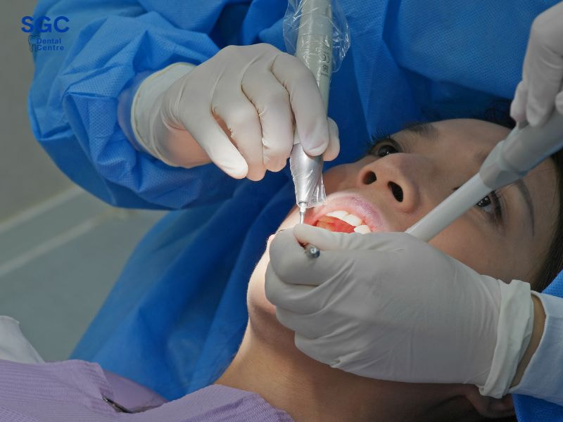 SGC miễn phí điều trị bệnh lý răng miệng khi trồng Implant