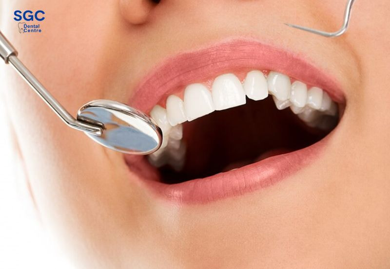 Tái khám định kỳ sau khi cấy ghép Implant