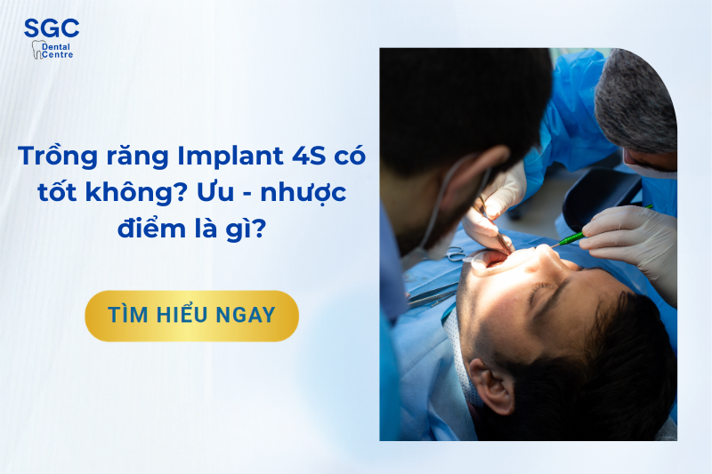 Trồng răng Implant 4s là gì?