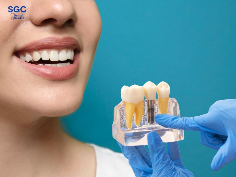 Trồng răng Implant cần đảm bảo sức khỏe tốt