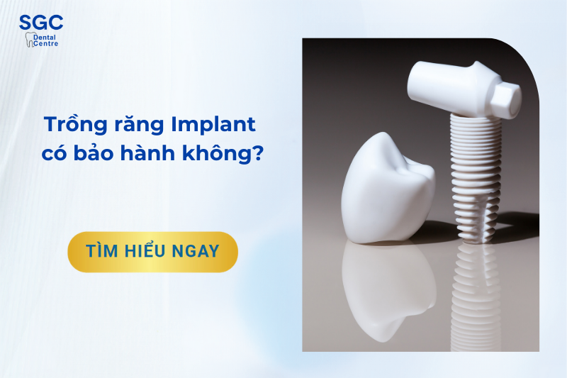 Trồng răng Implant có bảo hành không?