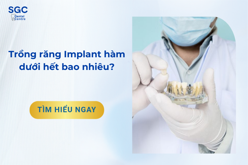 Trồng răng Implant hàm dưới