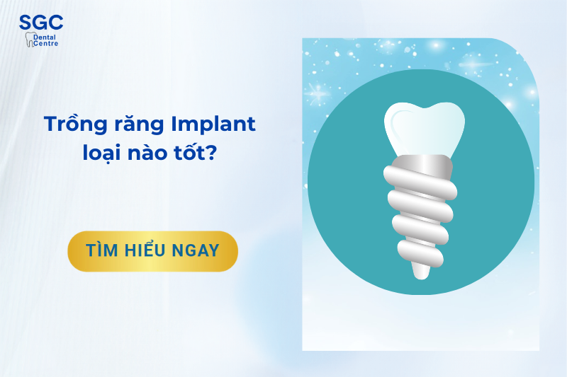 Trồng răng implant loại nào tốt?