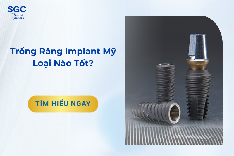 Trồng răng Implant Mỹ có tốt không?