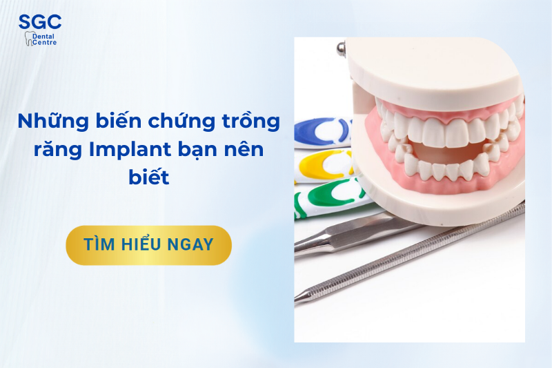 Biến chứng trồng răng Implant mà bạn nên biết