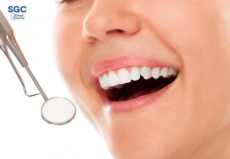 Chăm sóc trụ Implant cẩn thận là cách để có nụ cười tự tin