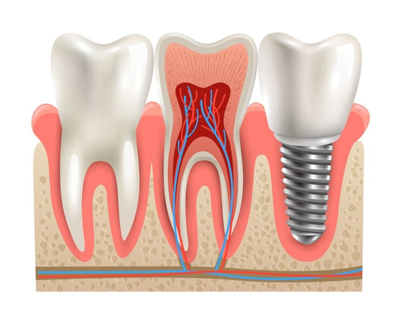 Sai sót trong phẫu thuật có thể tác động đến dây thần kinh