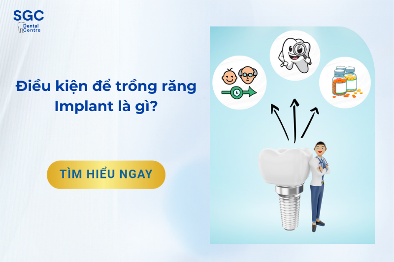 Điều kiện để trồng răng Implant: Độ tuổi, sức khỏe?