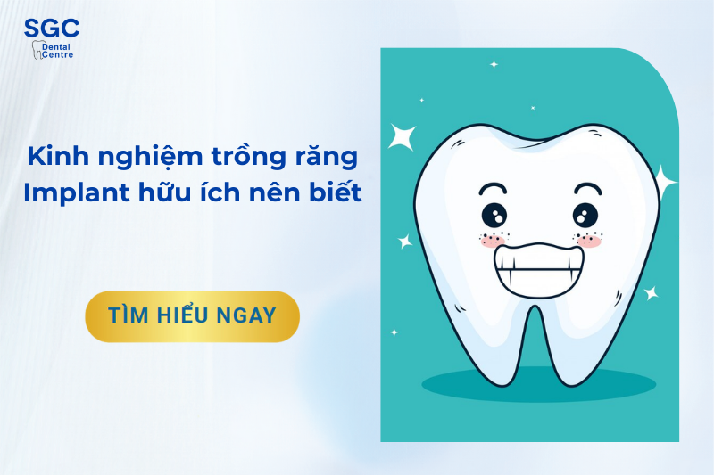 Kinh nghiệm trồng răng Implant hữu ích nhất