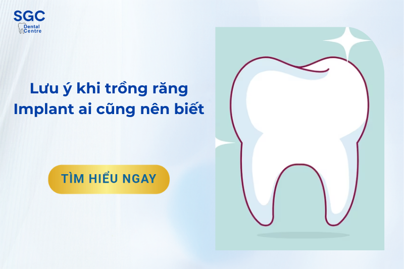 Lưu ý khi trồng răng Implant ai cũng nên biết