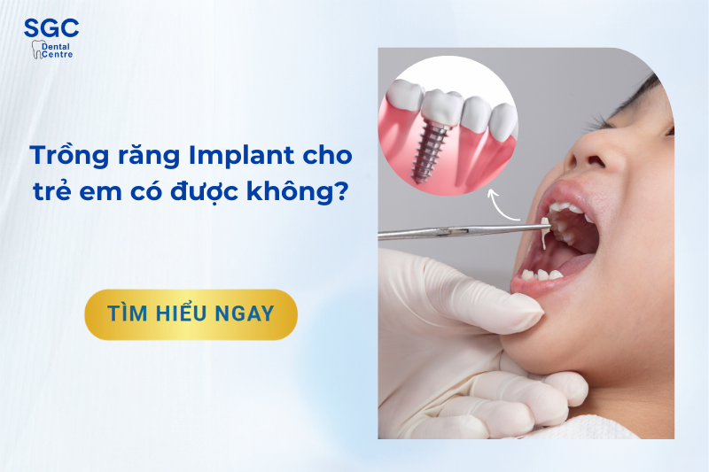 Trồng răng Implant cho trẻ em có được không?