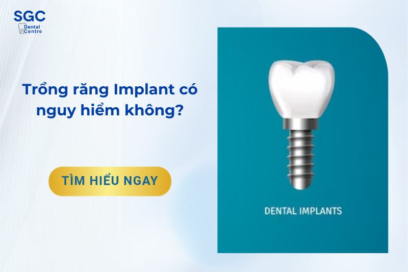 Trồng răng Implant có nguy hiểm không?