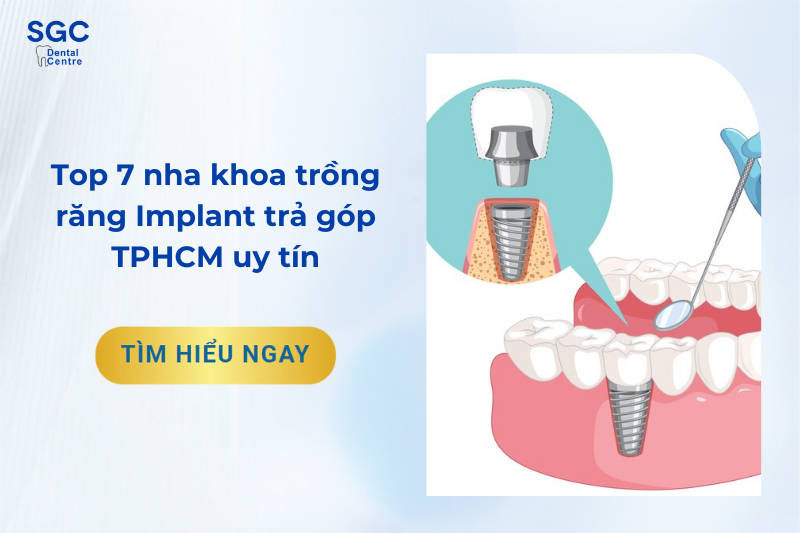 Top 7 nha khoa trồng răng Implant trả góp TPHCM uy tín 2024