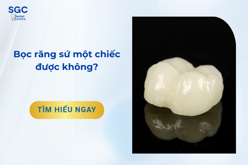 bọc răng sứ 1 chiếc được không