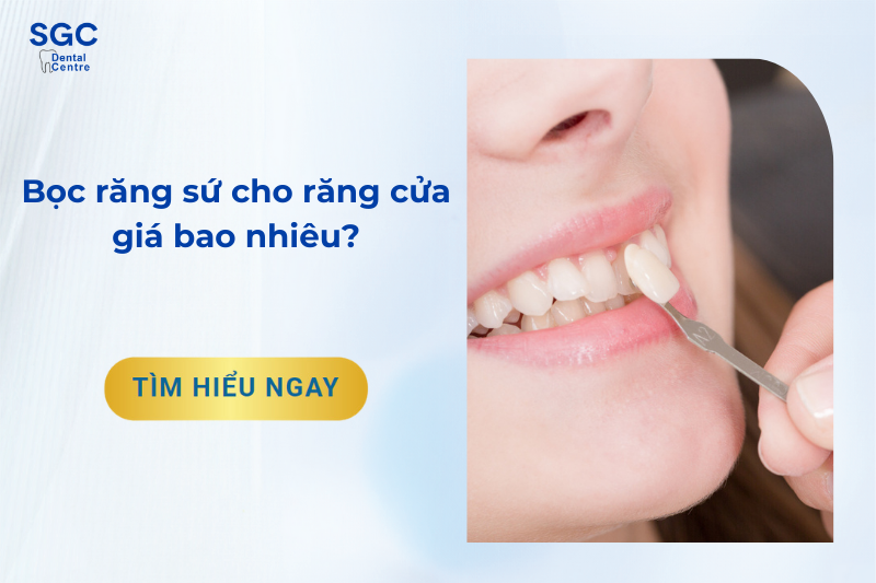 Bọc răng sứ cho răng cửa giá bao nhiêu