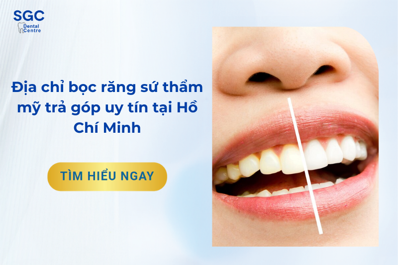 Địa chỉ bọc răng sứ thẩm mỹ trả góp uy tín nên biết