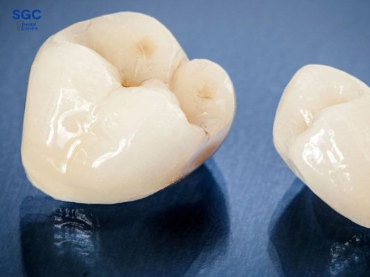 Chi phí bọc 1 chiếc răng sứ tùy thuộc vào giá và vật liệu