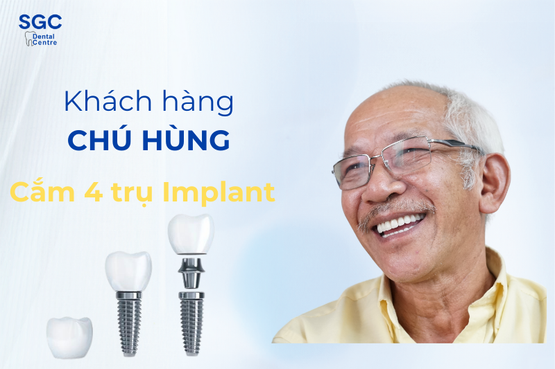 Review trồng răng Implant của chú Hùng