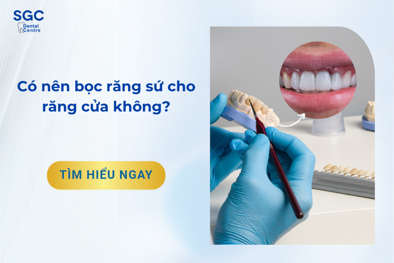 Có nên bọc sứ răng cửa không