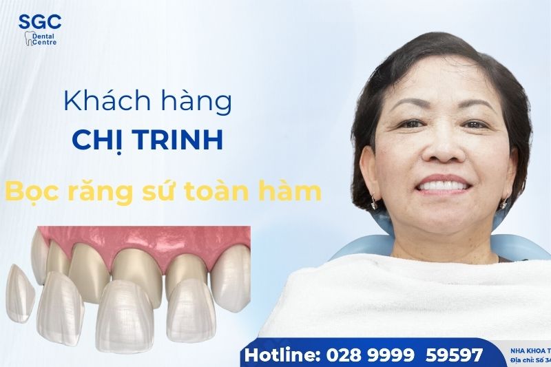 Đánh giá khi bọc răng sứ của chị Trinh