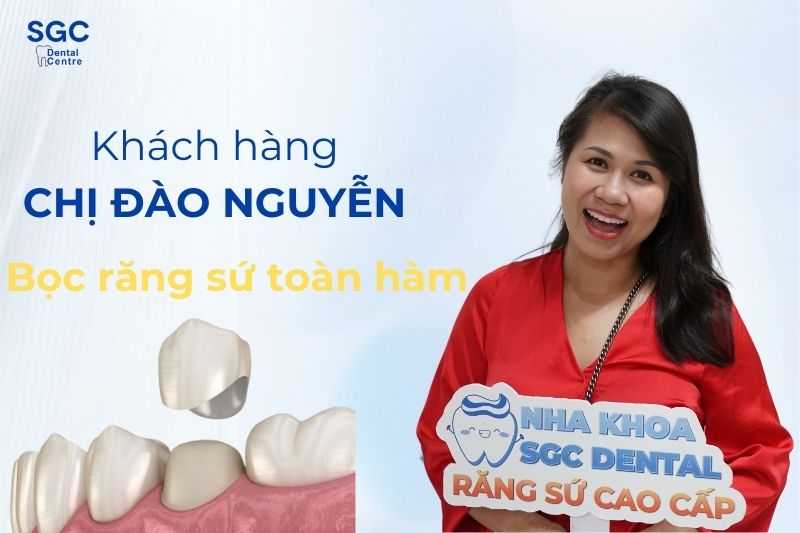 Review bọc răng sứ mà chị Đào Nguyễn chia sẻ