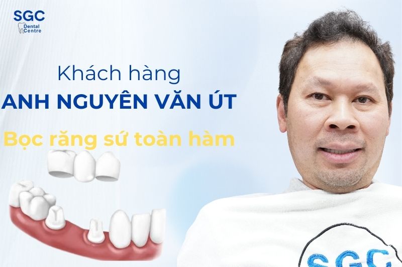 Khách hàng Nguyễn Văn Út sử dụng dịch vụ bọc răng sứ