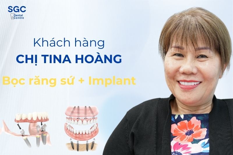 Khách hàng Tina Hoàng sử dụng dịch vụ bọc răng sứ