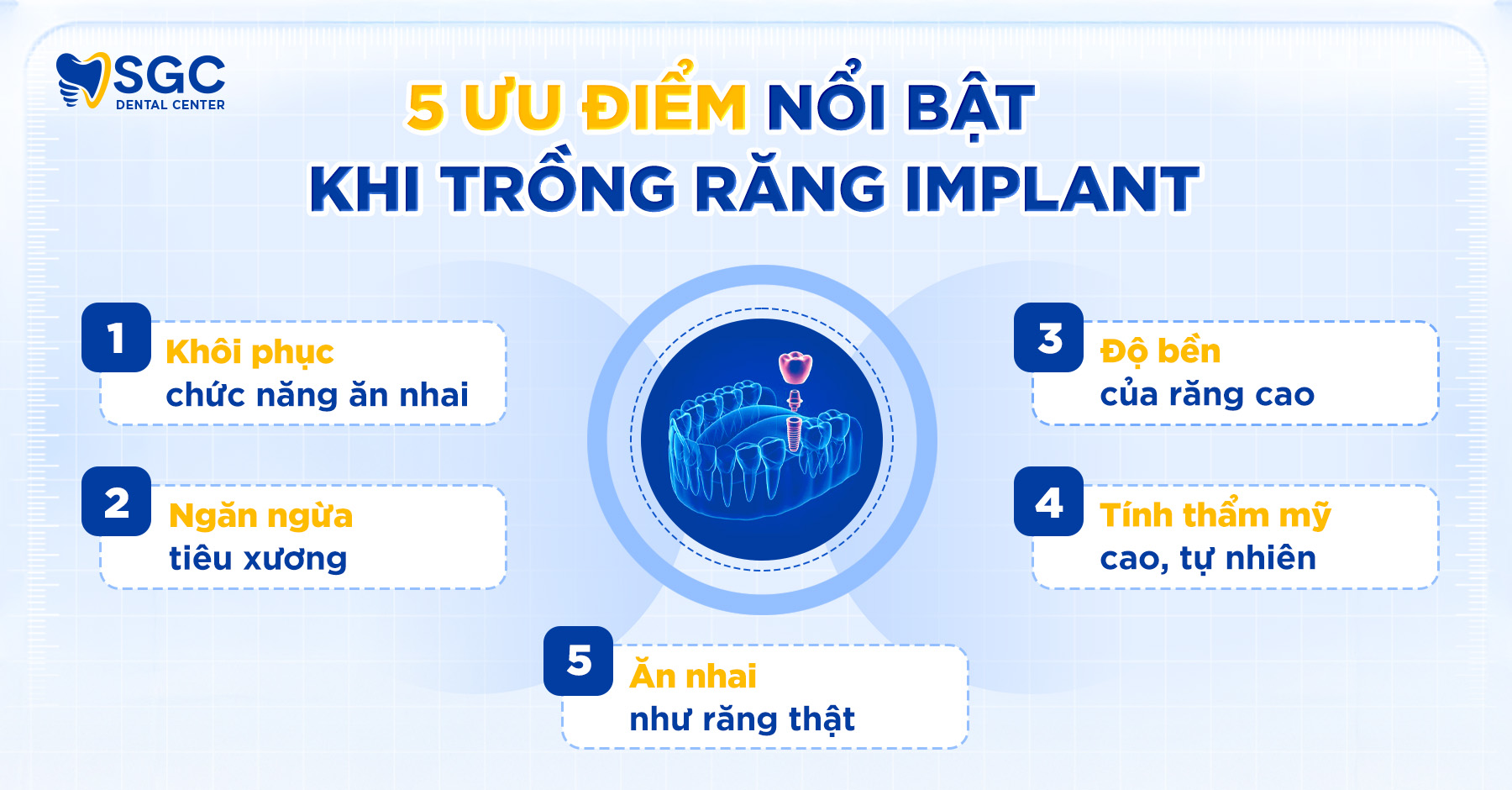 Trồng răng Implant là gì? Giải đáp chi tiết từ A đến Z 3 5 uu diem 1