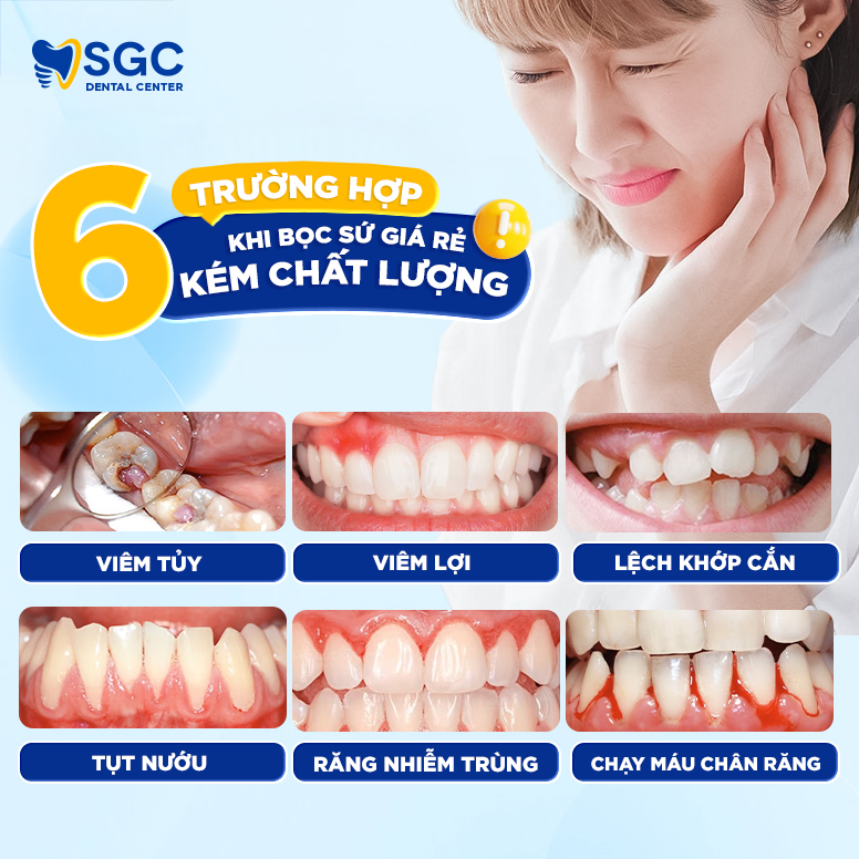 Bọc răng sứ thẩm mỹ là gì? Có tốt không? Bảng giá năm 2025 5 6 tac hai khi boc rang su gia re