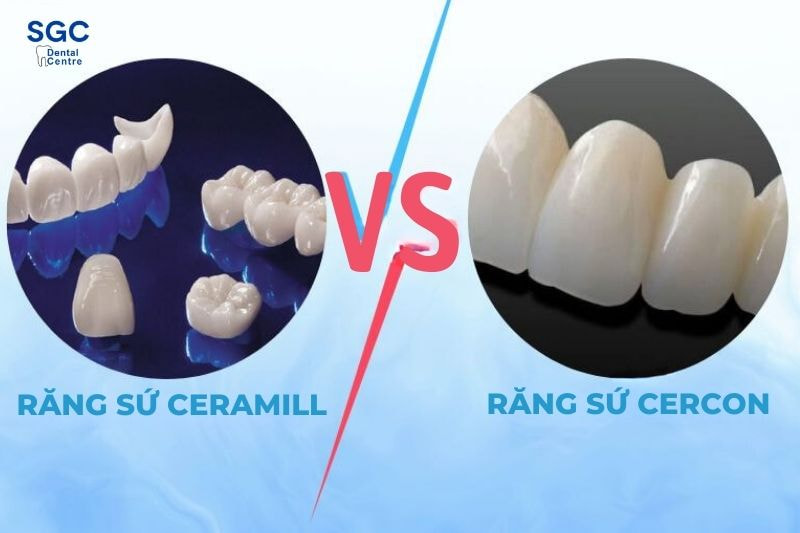 Sứ Ceramill đem lại hiệu quả thẩm mỹ cao hơn