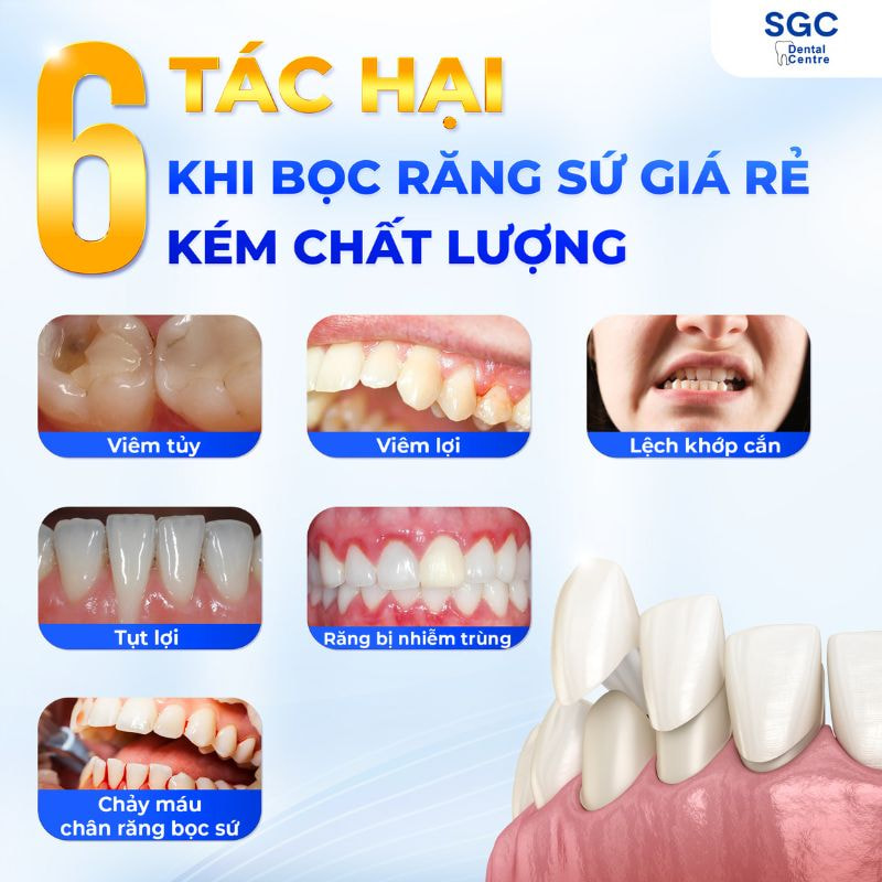 Bọc sứ kém chất lượng gây ra nhiều biến chứng răng miệng nguy hiểm