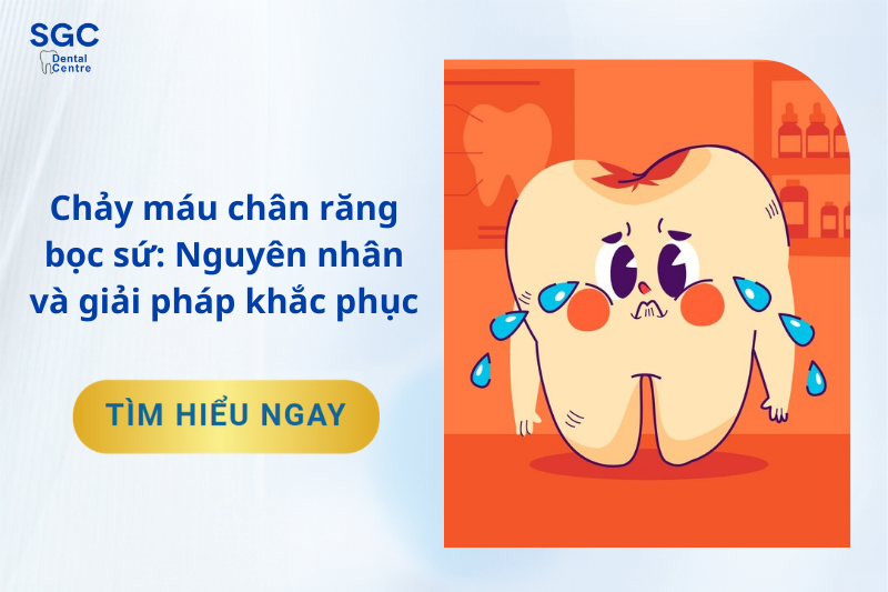 Chảy máu chân răng bọc sứ: Nguyên nhân và các giải pháp