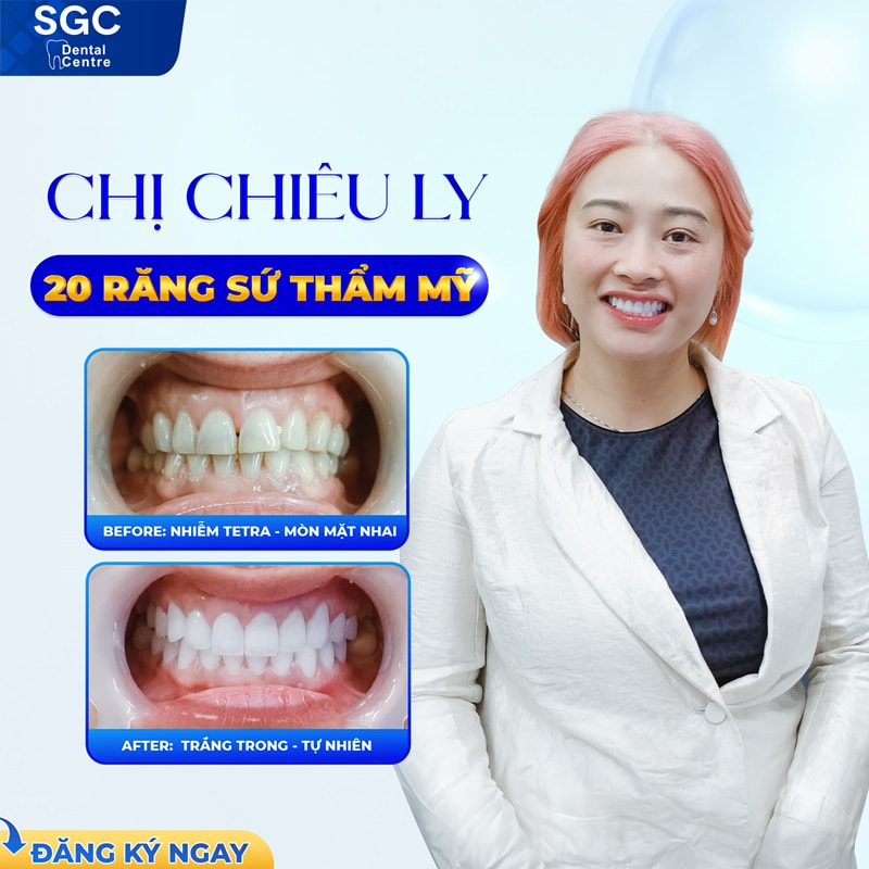 Tại Nha khoa SGC, sự uy tín luôn được đặt lên hàng đầu