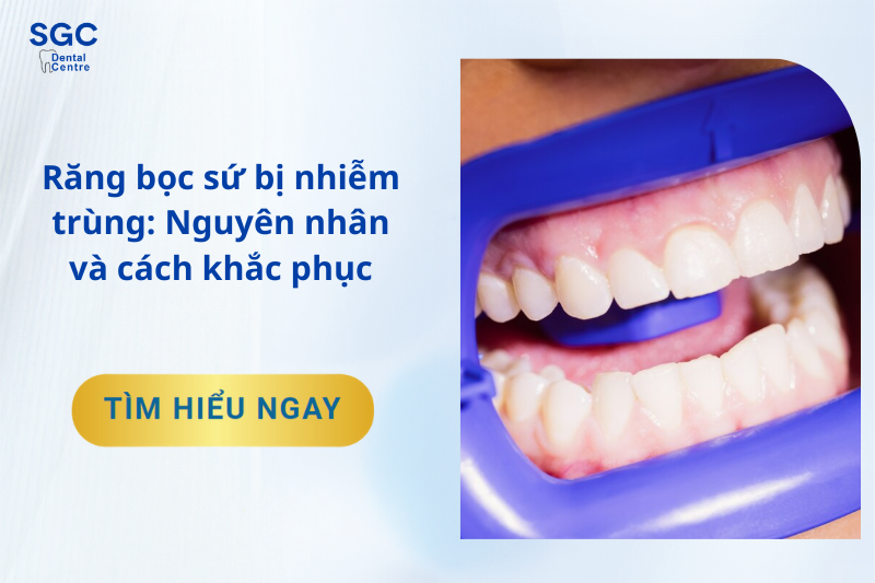 Răng bọc sứ bị nhiễm trùng: Nguyên nhân và cách khắc phục