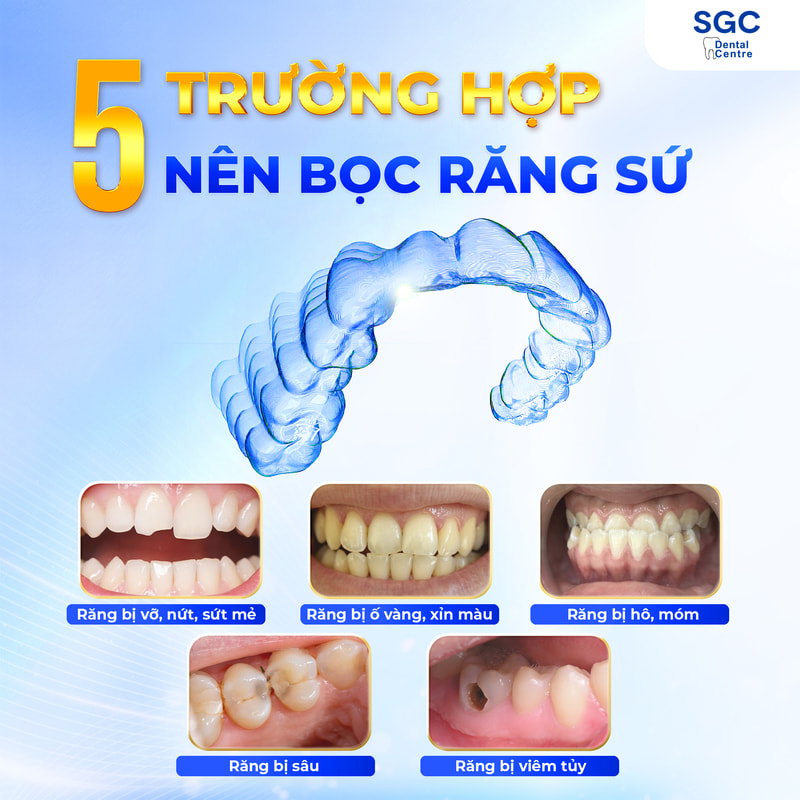 Răng có khuyết điểm nên bọc sứ răng để cải thiện