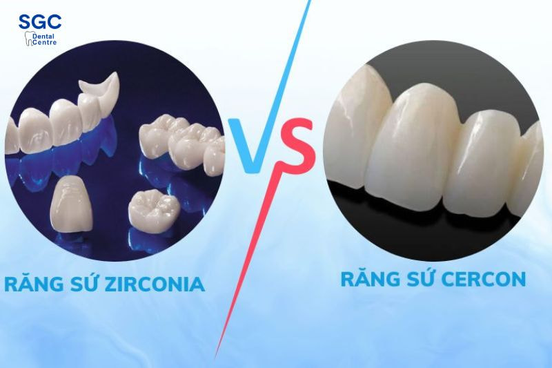 Răng bọc sứ Zirconia có tuổi thọ cao hơn dòng Cercon