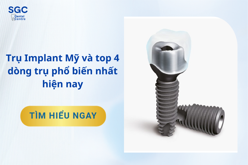 Top 4 trụ Implant Mỹ phổ biến