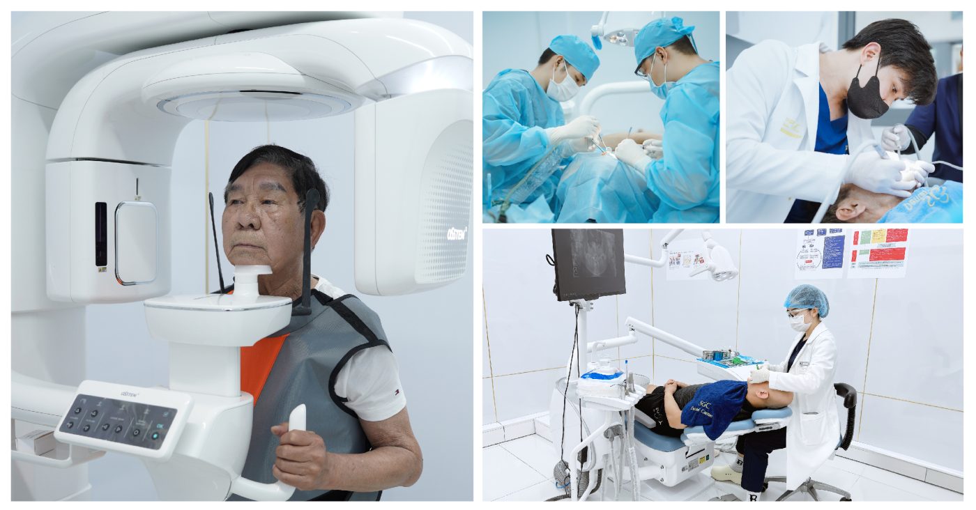 Bọc răng sứ thẩm mỹ là gì? Có tốt không? Bảng giá năm 2025 8 sgccccc 04