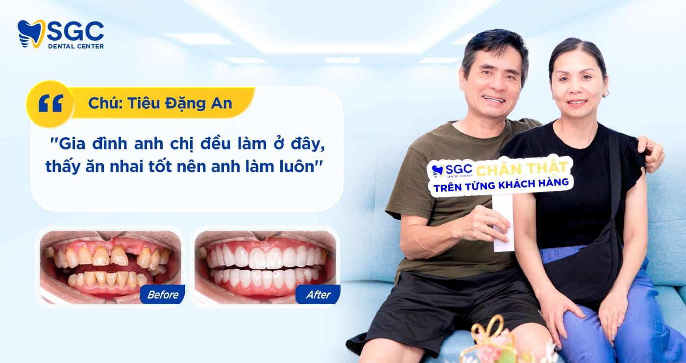 Trồng răng Implant 32 Chu Tieu Dang an