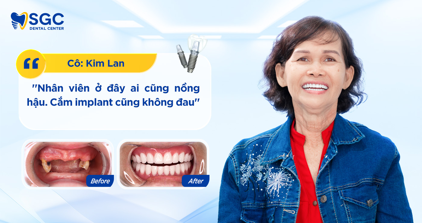 Trồng răng Implant 33 Co Kim La