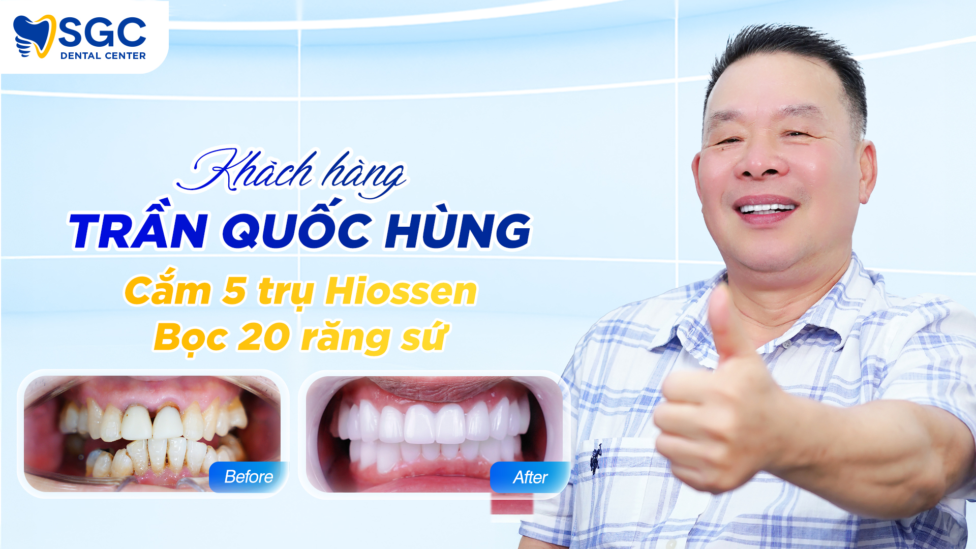 Khách hàng trồng răng sứ Trần quốc Hùng
