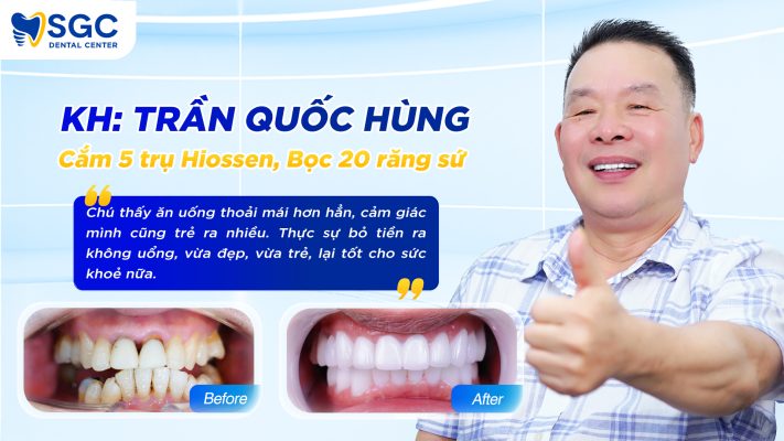 TRAN QUOC HUNG 711x400 1