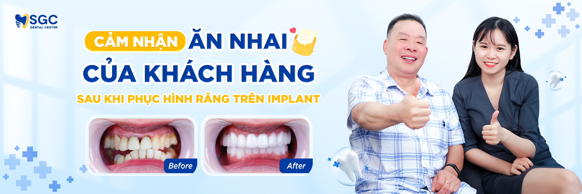Trồng răng Implant 18 cam nhan an nhai 3