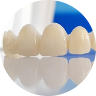 Bọc răng sứ thẩm mỹ 21 item 05