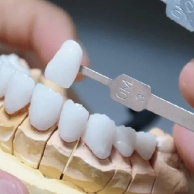 Bọc răng sứ thẩm mỹ 24 rang su lava plus 1